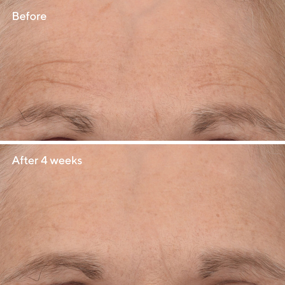 Murad | Retinal ReSculpt™ Overnight Treatment Deluxe Travel Size