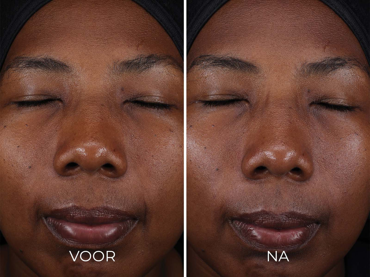 Image | DAILY PREVENTION - Pure Mineral Tinted Moisturizer SPF 30 - Delizia Skincare