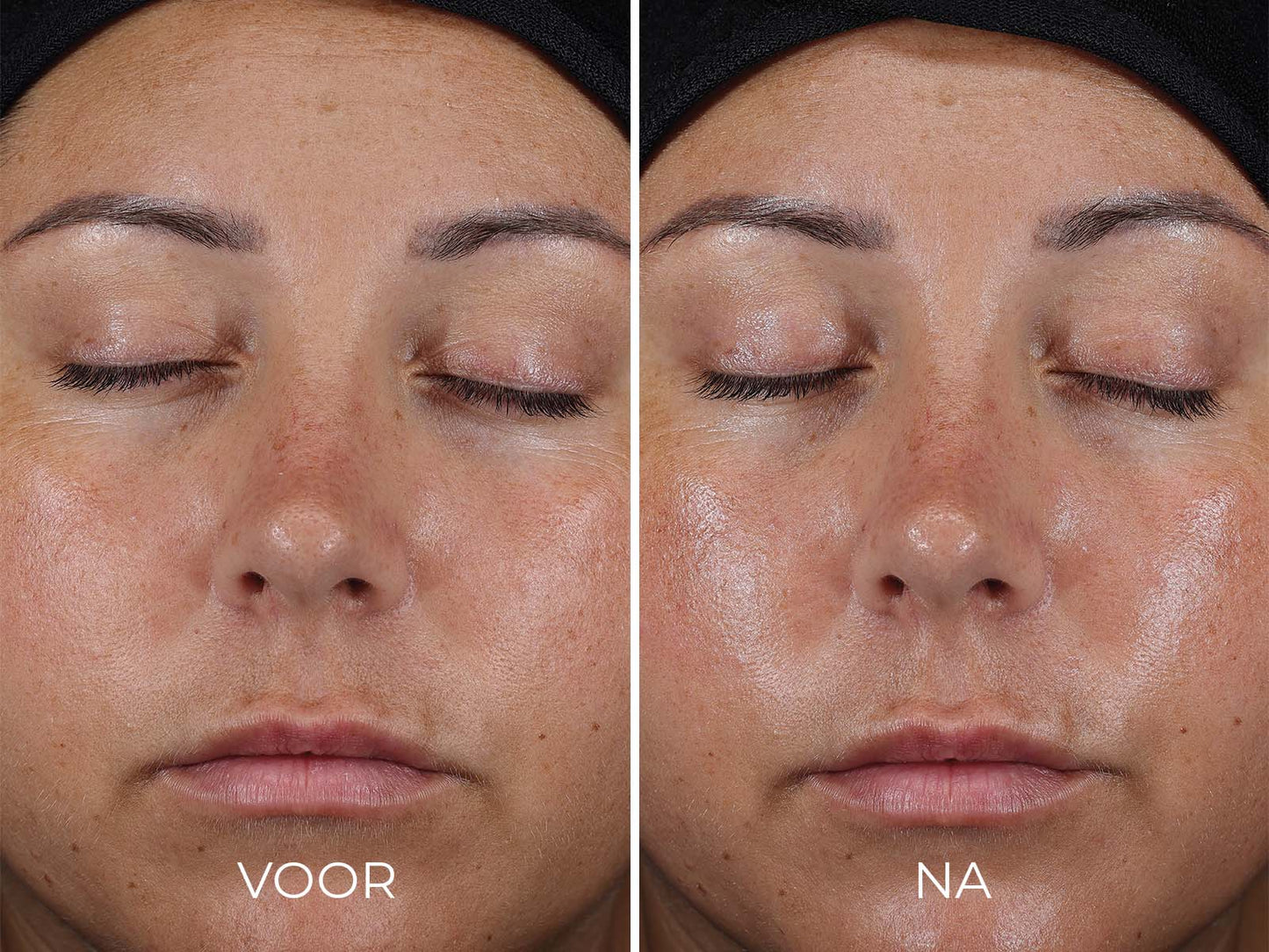 Image | DAILY PREVENTION - Ultra Defense Moisturizer SPF 50 - Delizia Skincare