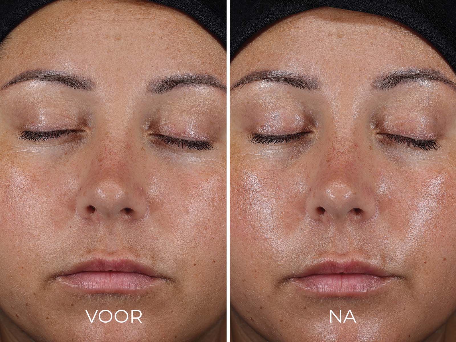 Image | DAILY PREVENTION - Ultra Defense Moisturizer SPF 50 - Delizia Skincare