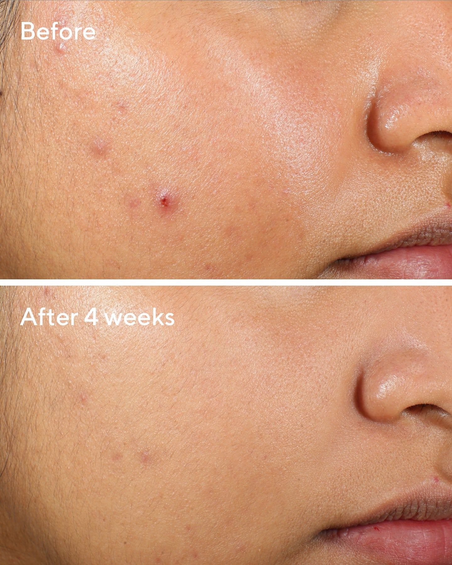 Murad | Clarifying Water Gel