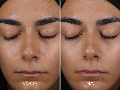 Image | Travel Size DAILY PREVENTION - Sheer Matte Moisturizer SPF 30 - Delizia Skincare