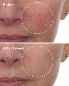 Murad | Cellular Hydration Barrier Repair Serum Deluxe Travel Size