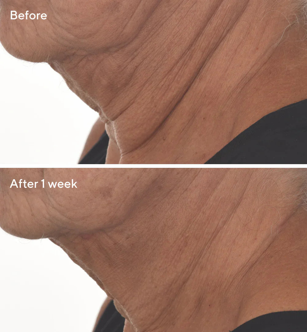 Murad | Retinal ReSculpt™ Overnight Treatment Refill Bundle