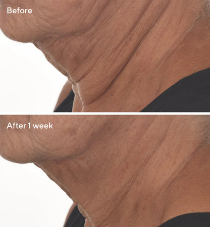 Murad | Retinal ReSculpt™ Overnight Treatment Refill Bundle