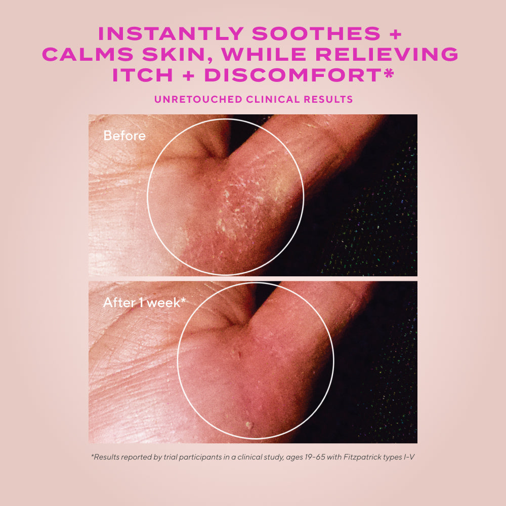 Murad | Quick Relief Moisture Treatment