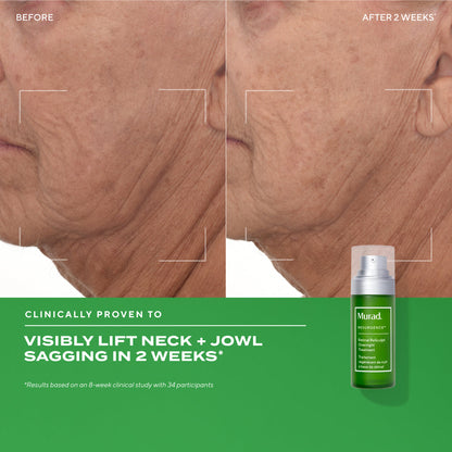 Murad | Retinal ReSculpt™ Overnight Treatment
