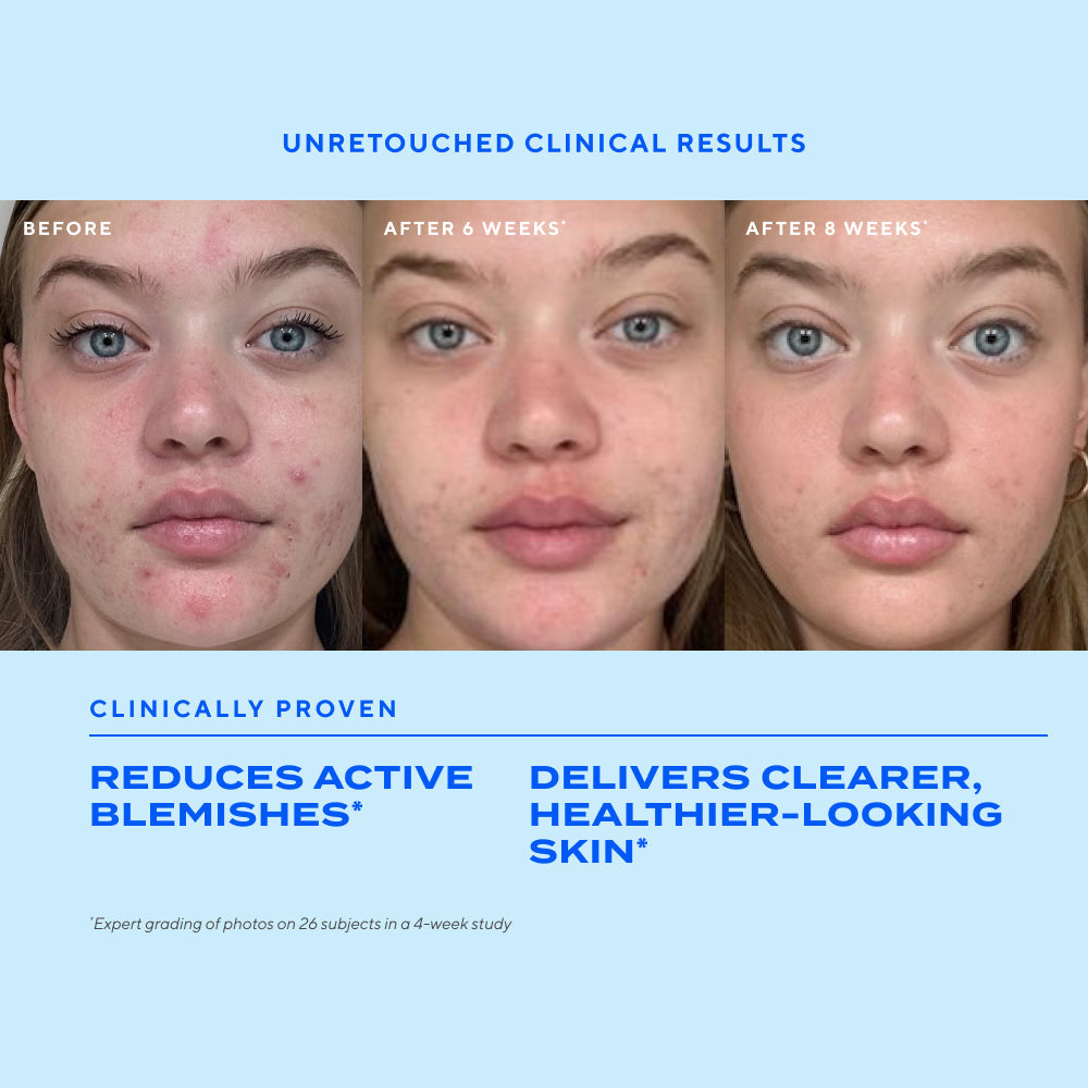 Murad | Biome-Balancing Clear & Prevent Blemish Treatment Serum