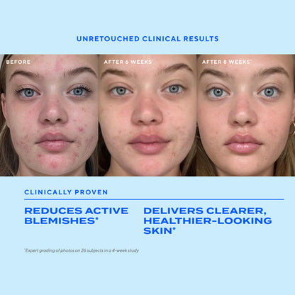 Murad | Biome-Balancing Clear & Prevent Blemish Treatment Serum