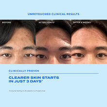 Murad | Biome-Balancing Clear & Prevent Blemish Treatment Serum