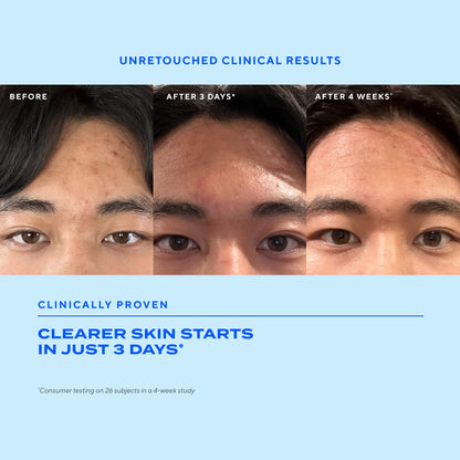 Murad | Biome-Balancing Clear & Prevent Blemish Treatment Serum