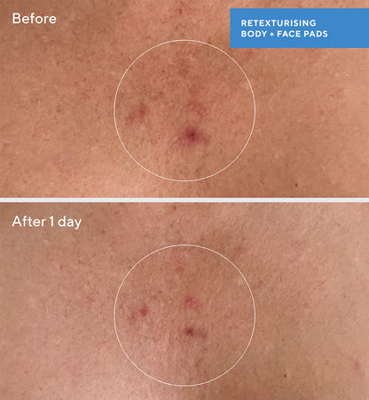 Murad | Retexturising Body + Face Pads