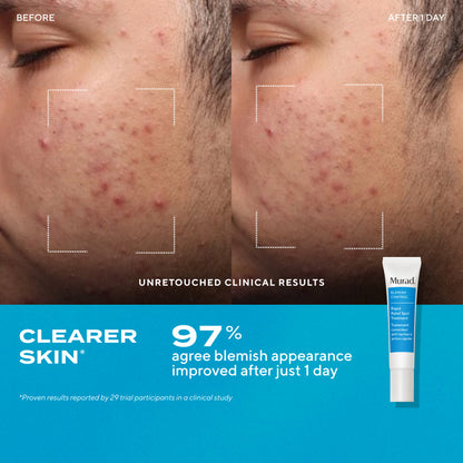 Murad | Blemish Control Kit