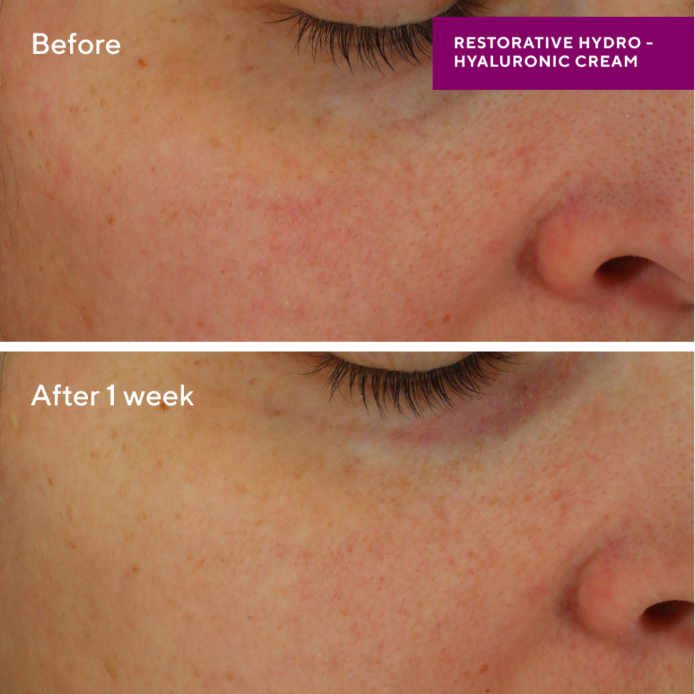 Murad | Restorative Hydro-Hyaluronic Cream