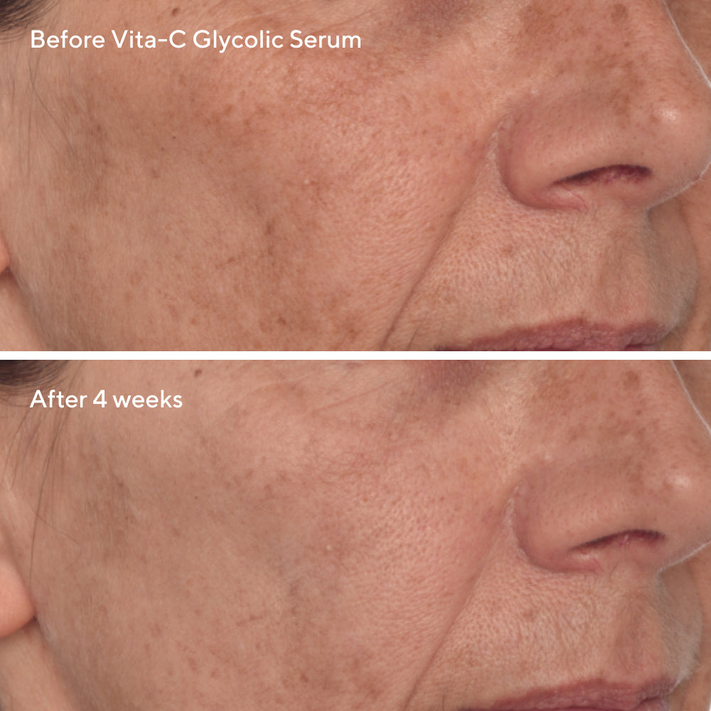 Murad | Radiant Skin Discovery Kit