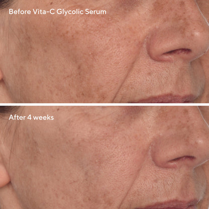 Murad | Radiant Skin Discovery Kit