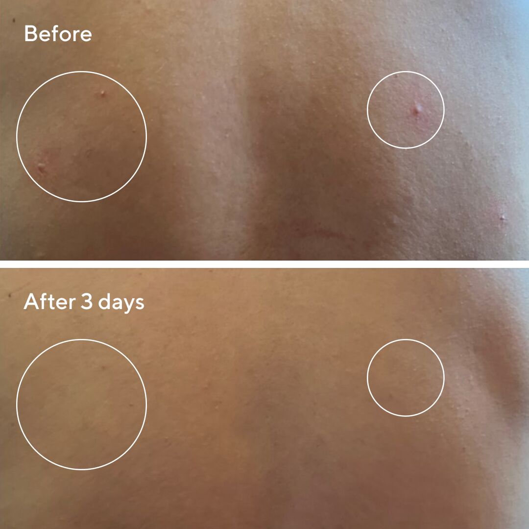 Murad | Retexturising Body + Face Pads