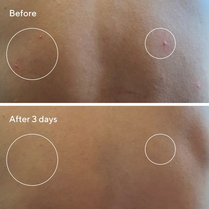 Murad | Retexturising Body + Face Pads