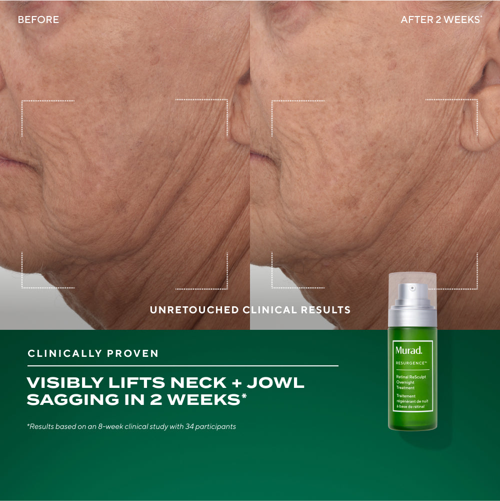 Murad | The Retinal ReSculptors Gift Set