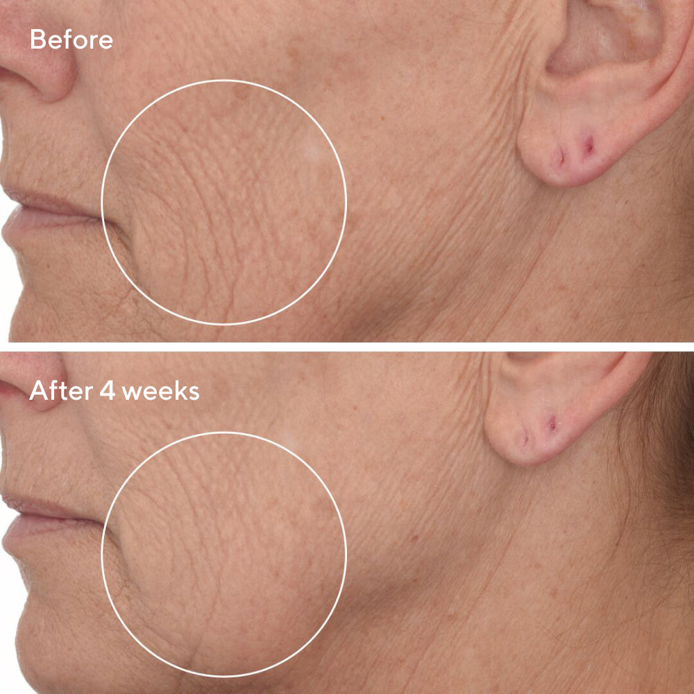 Murad | Retinal ReSculpt™ Overnight Treatment Deluxe Travel Size