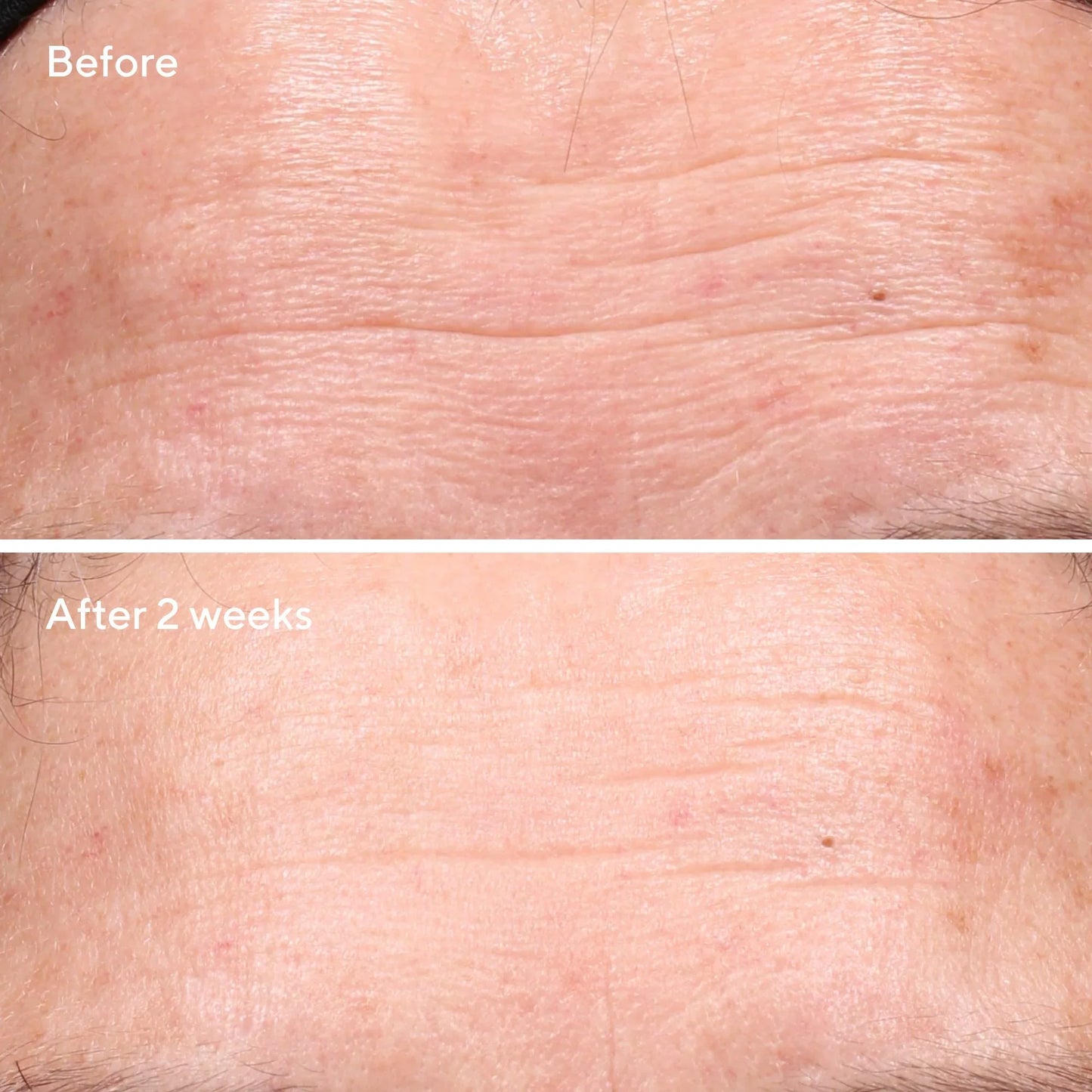 Murad | Retinol Youth Renewal Serum