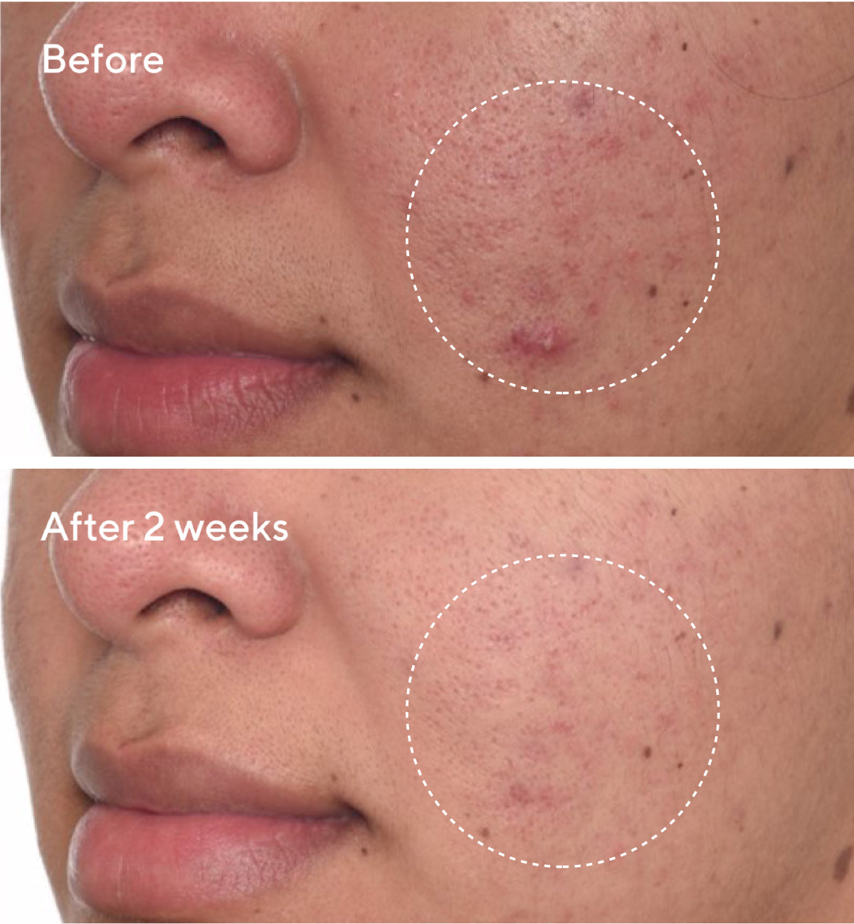 Murad | Rapid Dark Spot Correcting Serum