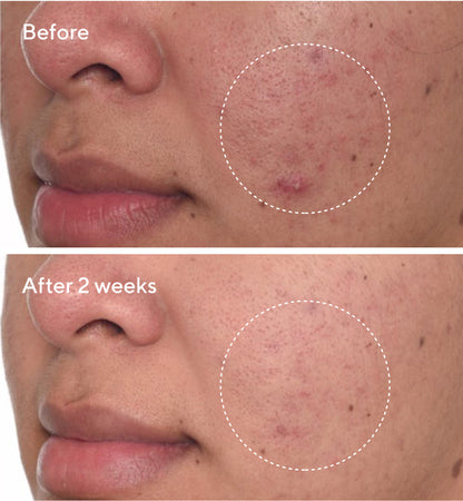 Murad | Rapid Dark Spot Correcting Serum