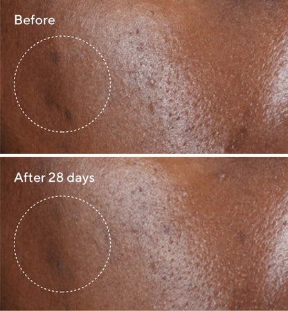 Murad | Rapid Dark Spot Correcting Serum