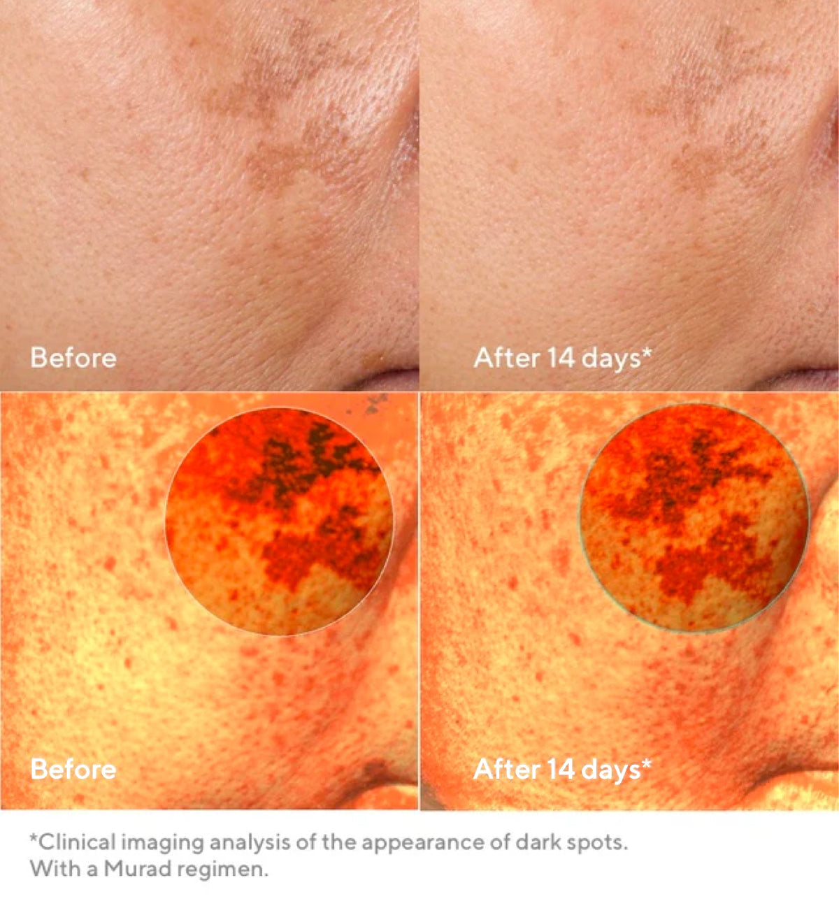 Murad | Rapid Dark Spot Correcting Serum