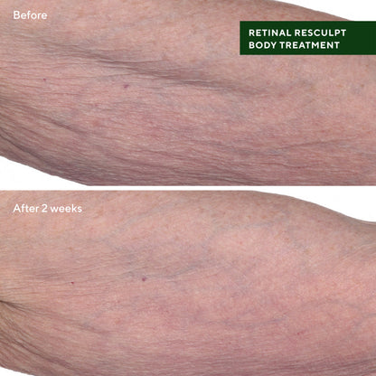 Murad | Retinal ReSculpt Body Treatment