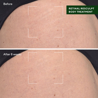 Murad | Retinal ReSculpt Body Treatment