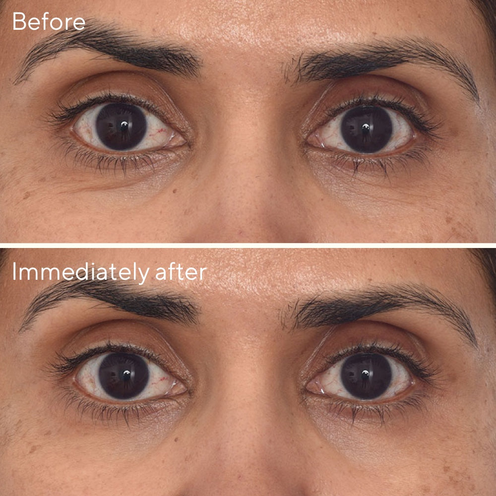 Murad | Retinol Youth Renewal Eye Masks