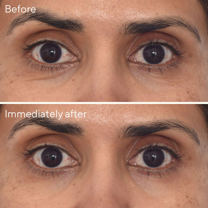 Murad | Retinol Youth Renewal Eye Masks