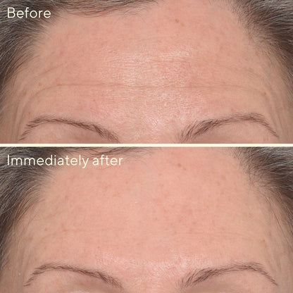 Murad | Targeted Wrinkle Corrector