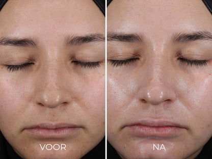 Image | Travel Size DAILY PREVENTION - Pure Mineral Hydrating Moisturizer SPF 30 - Delizia Skincare