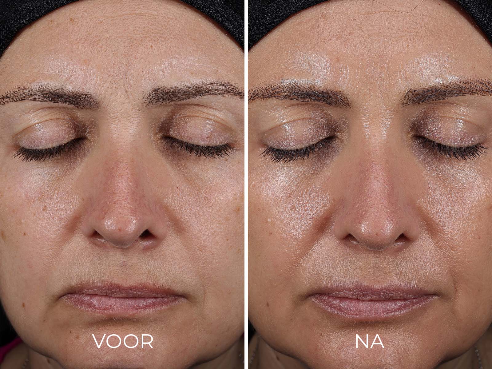 Image | DAILY PREVENTION - Advanced Smartblend Mineral Moisturizer SPF 50+ - Delizia Skincare