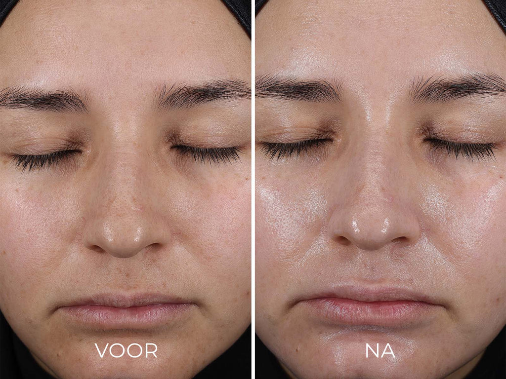 Image | DAILY PREVENTION - Pure Mineral Hydrating Moisturizer SPF 30 - Delizia Skincare