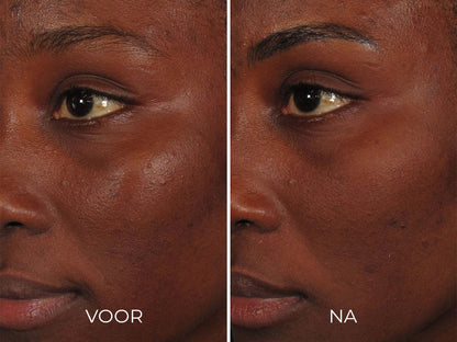 Image | ILUMA - Intense Facial Illuminator - Delizia Skincare