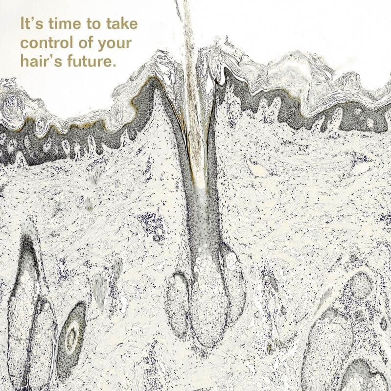 Insentials | Hair Strength+ Follicure™ - Delizia Skincare