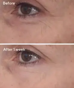 513200 RetinalReSculptEyeTreatment BA Position2 46554.1697850440.1280.1280 Murad Skincare Murad Retinal ReSculpt Eye Lift Treatment